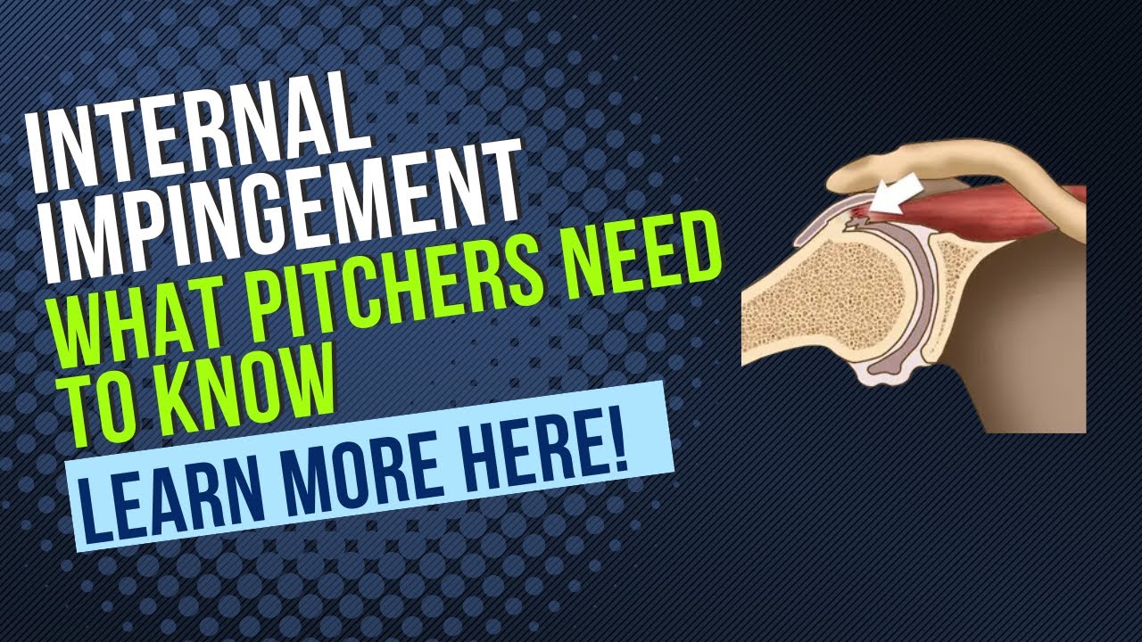 How to Identify Internal Impingement In Pitchers