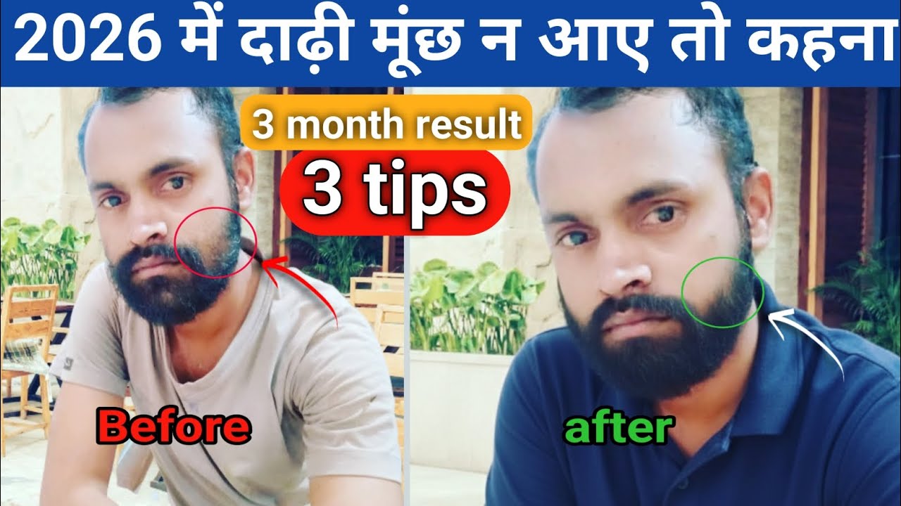 Beard growth kaise kare 2026, beard growth, Beard growth tips, how to grow beard 