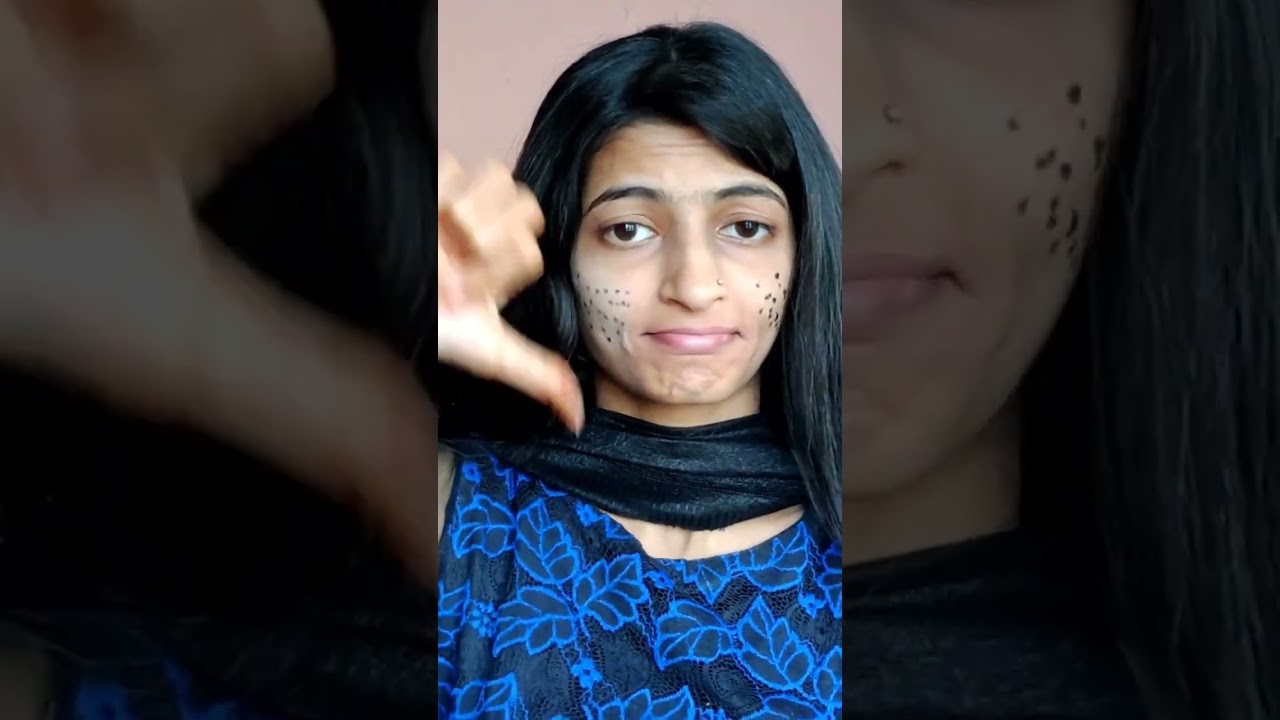 Makeup Tips 😱 Hide your Dark spots 😍 