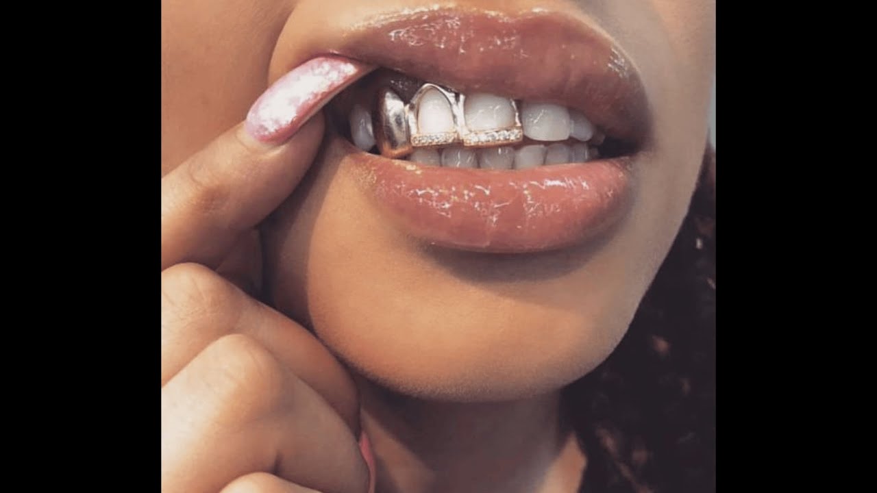 (FREE) Bouyon x R&B Type Beat 2025 