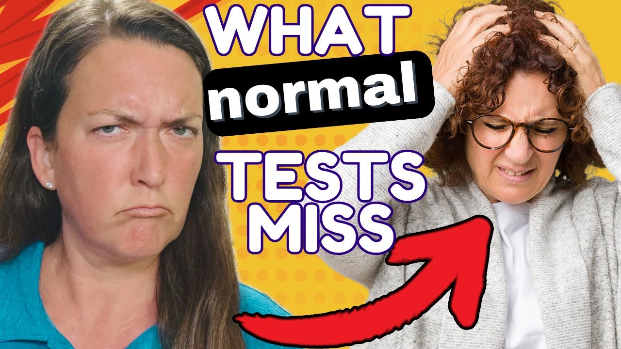 BPPV with a Normal VNG test is Difficult to Catch Here's Why | The Vertigo Detective