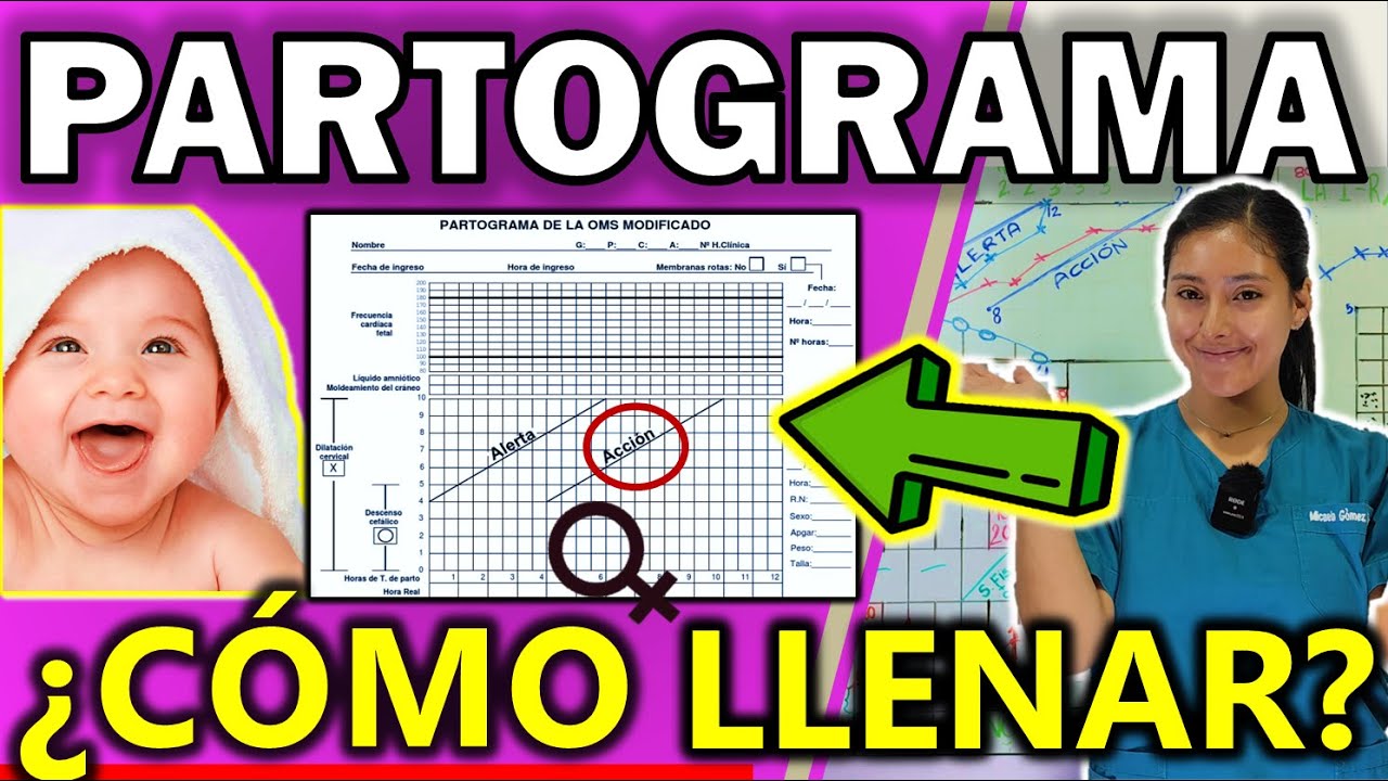 PARTOGRAMA COMO LLENAR OMS | GuiaMed