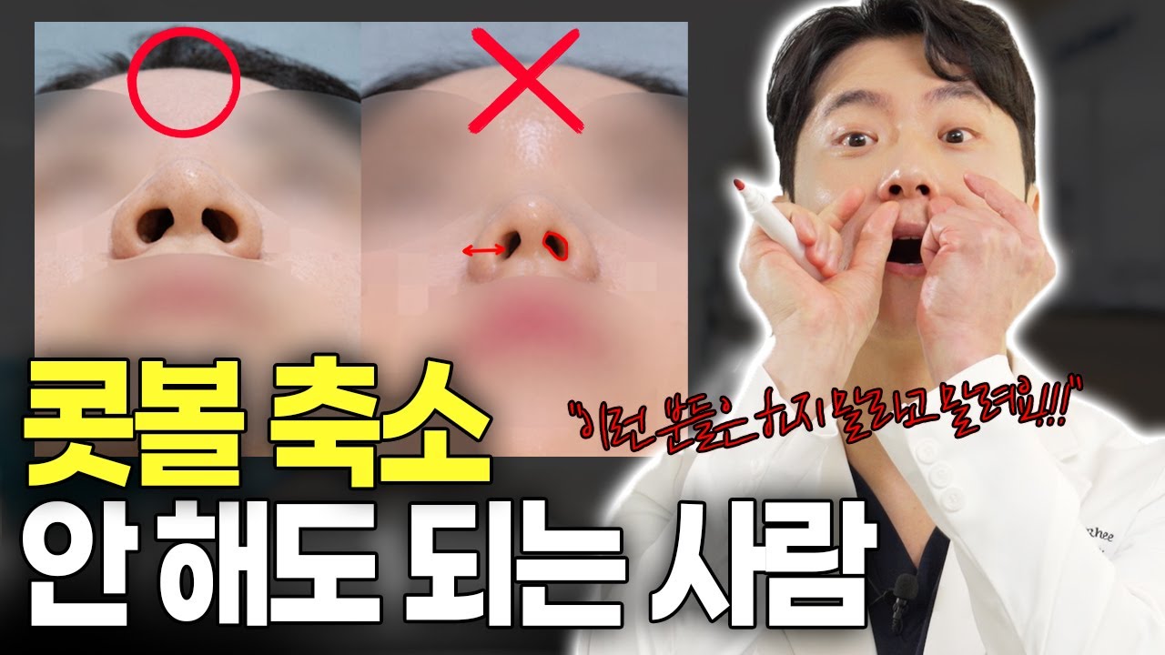 콧볼 축소 효과 좋은 코와 아닌 코 차이