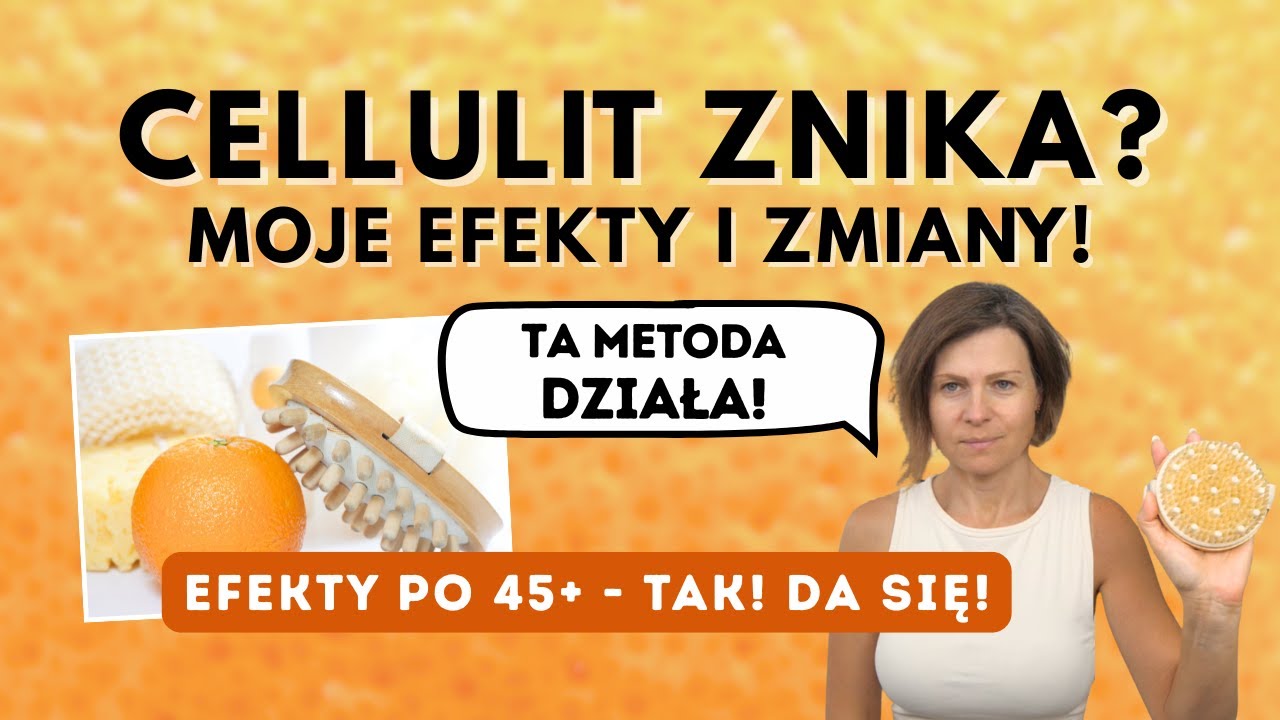 Cellulit po 45? Moje prawdziwe efekty szczotkowania na sucho &ndash; bez ćwiczeń i krem&oacute;w