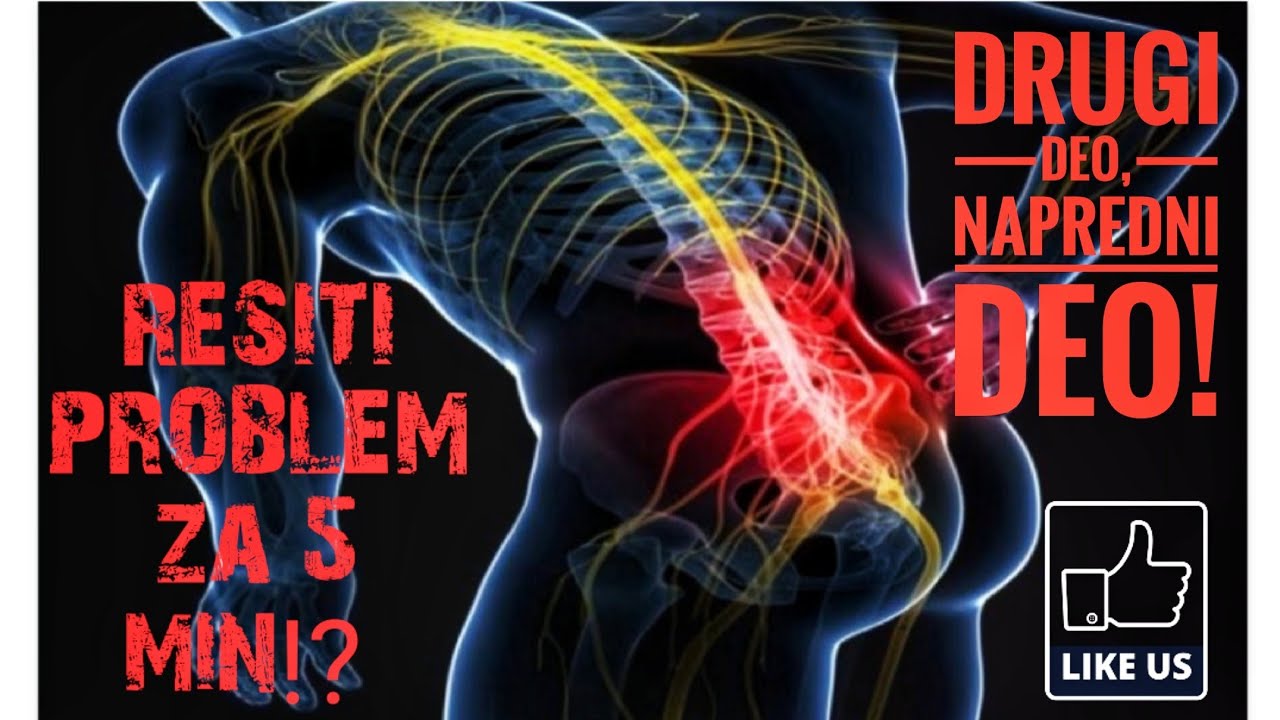 ISIJAS(Sciatica) bol u dodjem delu ledja i bol duz noge! (napredni deo) RESITE PROBLEM ZA 5 MIN!