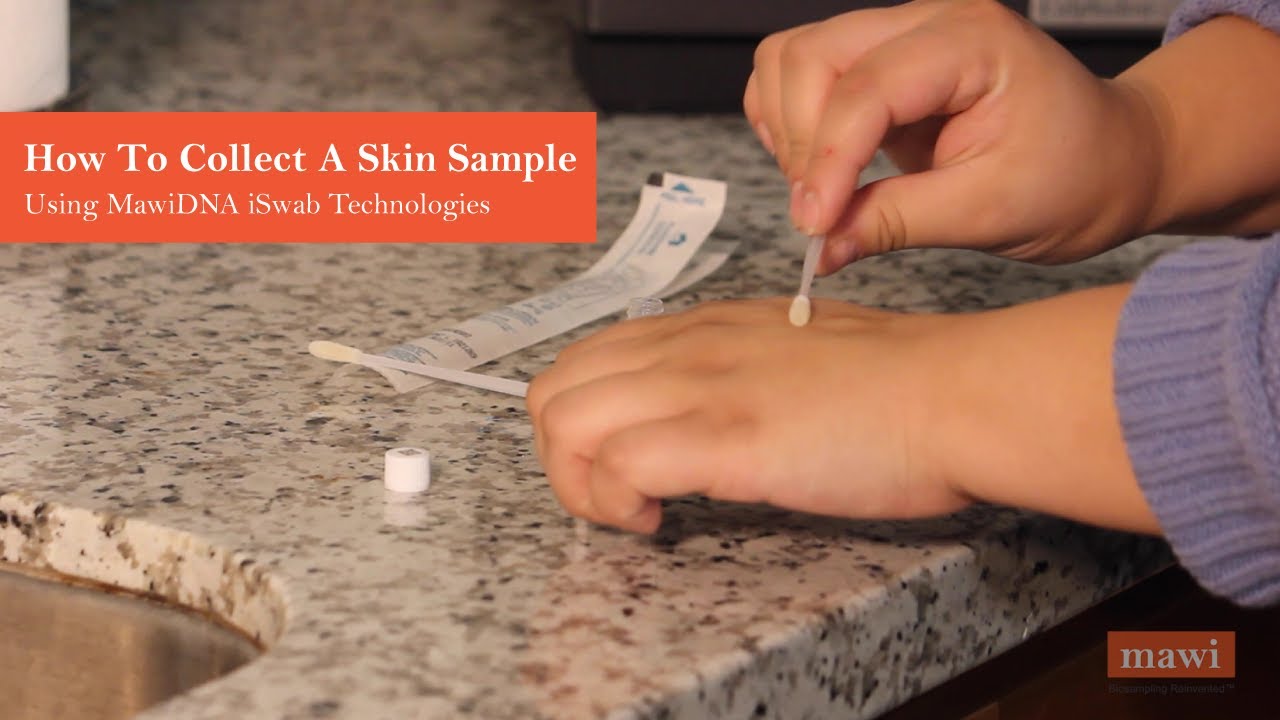 Collect Skin Samples with the iSWAB Microbiome Collection Kit | MawiDNA Technologies