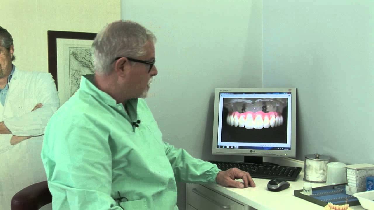 Overdenture