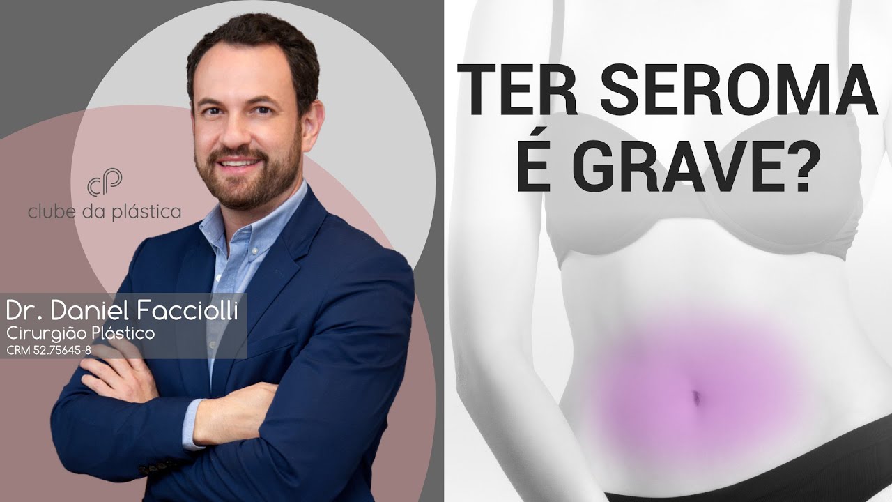 Clube da Plástica: Ter seroma é grave?