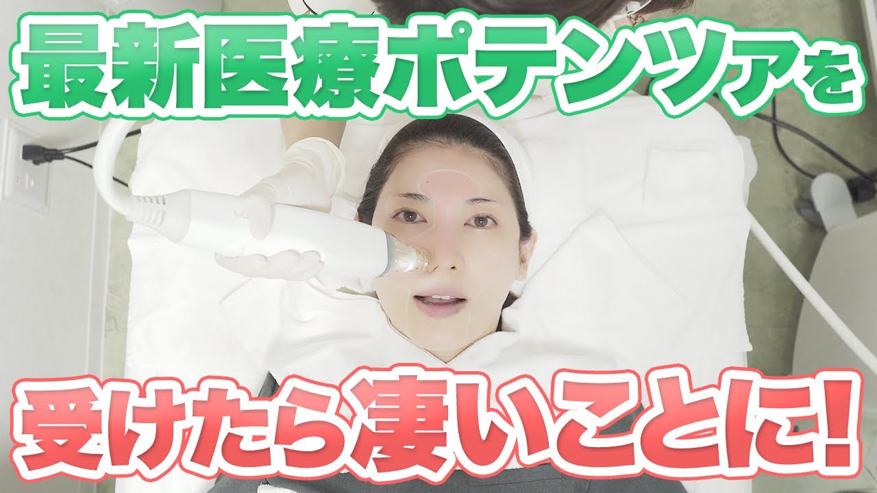 肌改善やばかった！最新治療「ニードルRFポテンツァ」受けてみたらスゴすぎました！