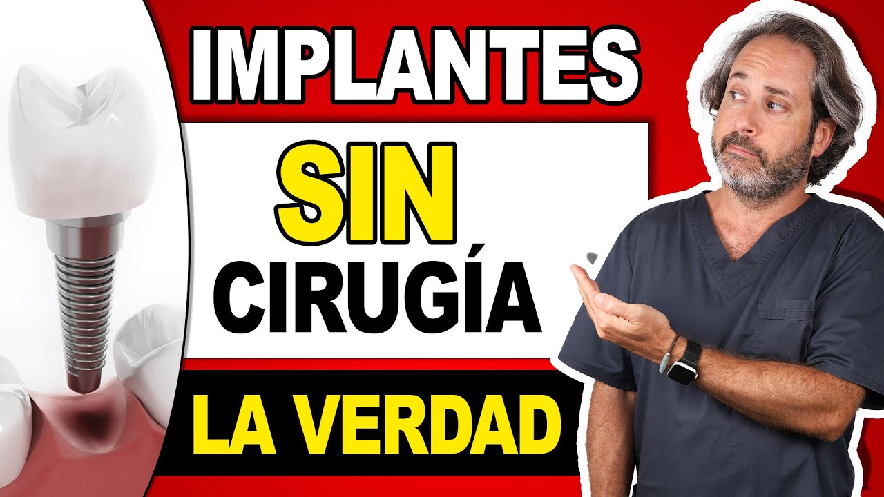 📌 Cómo son los Implantes dentales 𝗦𝗜𝗡 𝗖𝗜𝗥𝗨𝗚𝗜𝗔: ¿Una alternativa válida o un riesgo innecesario?