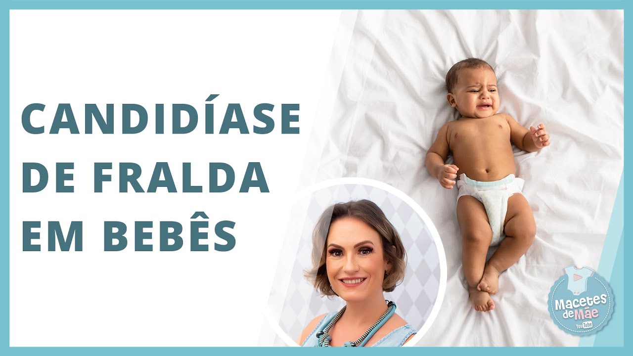 CANDIDÍASE DE FRALDA EM BEBÊS | MACETES DE MÃE