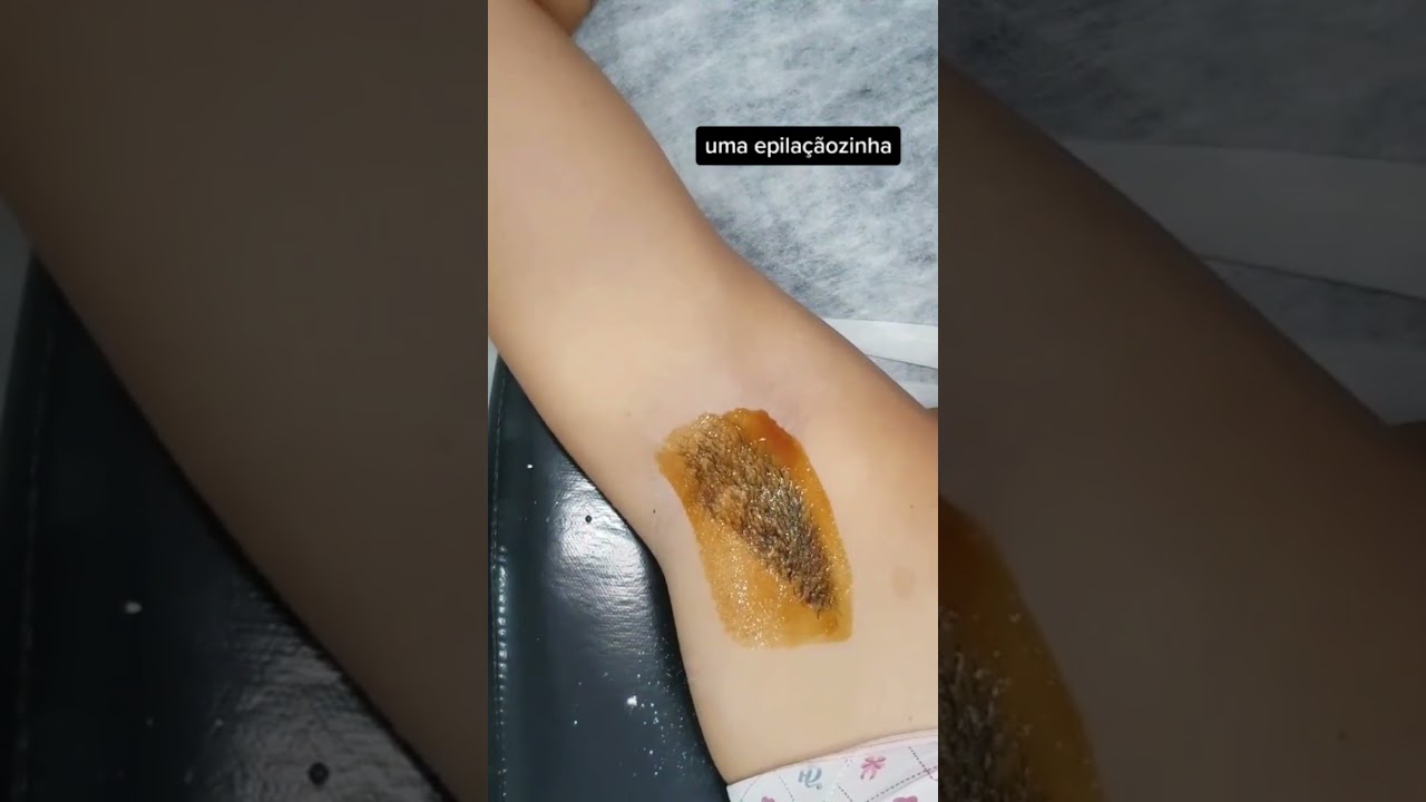 Depila&ccedil;&atilde;o de Axilas Feminina
