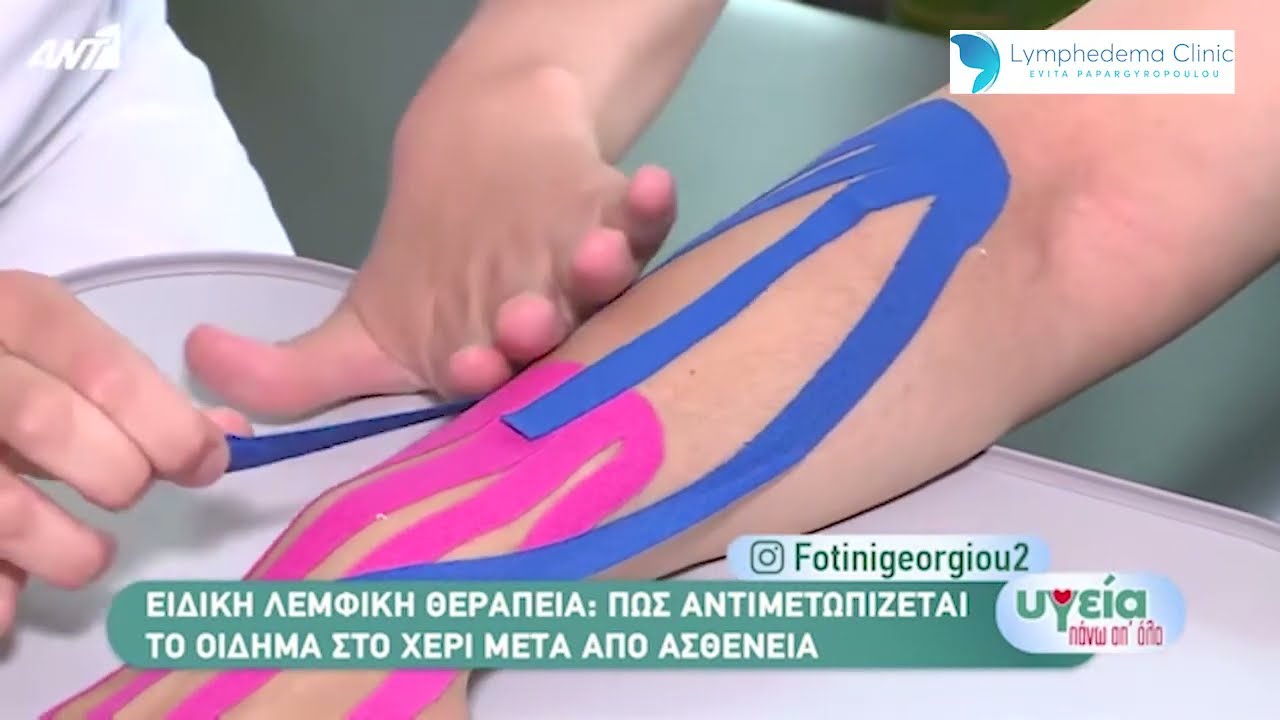 Λεμφοίδημα άνω άκρου και θεραπεία | Lymphedema Clinic Evita Papargyropoulou