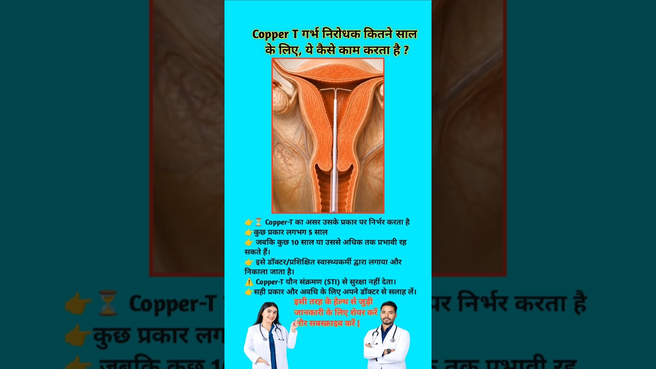 Copper T गर्भ निरोधक कितने साल    के लिए, ये कैसे काम करता है ? copper -t ll#shorts #viral #coppert