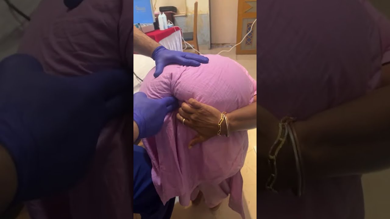 Chiropractor Treatment For Heavy Tailbone Pain #mumbai #delhi