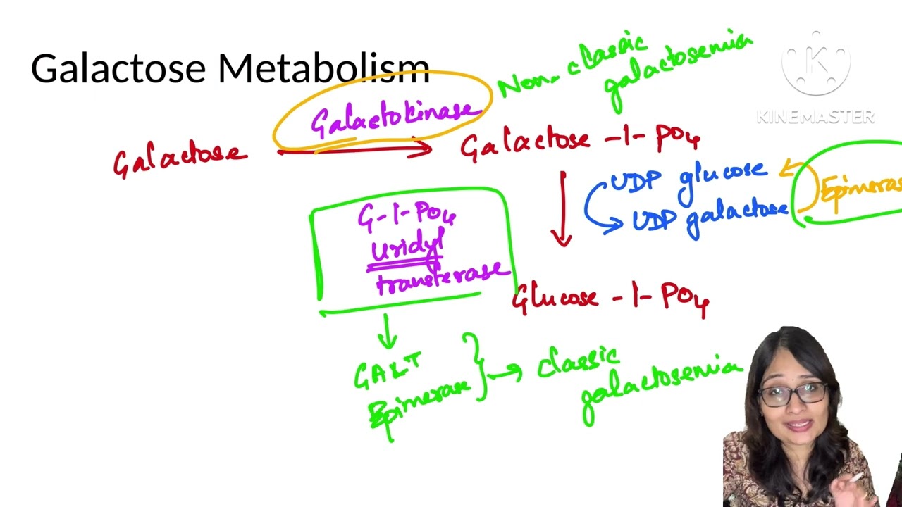 Galactose metabolism | Classic and Non classic Galactosemia