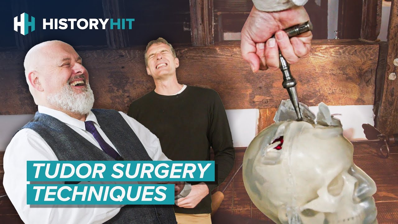 Battlefield Surgery In The Age of Gunpowder: The Gruesome History