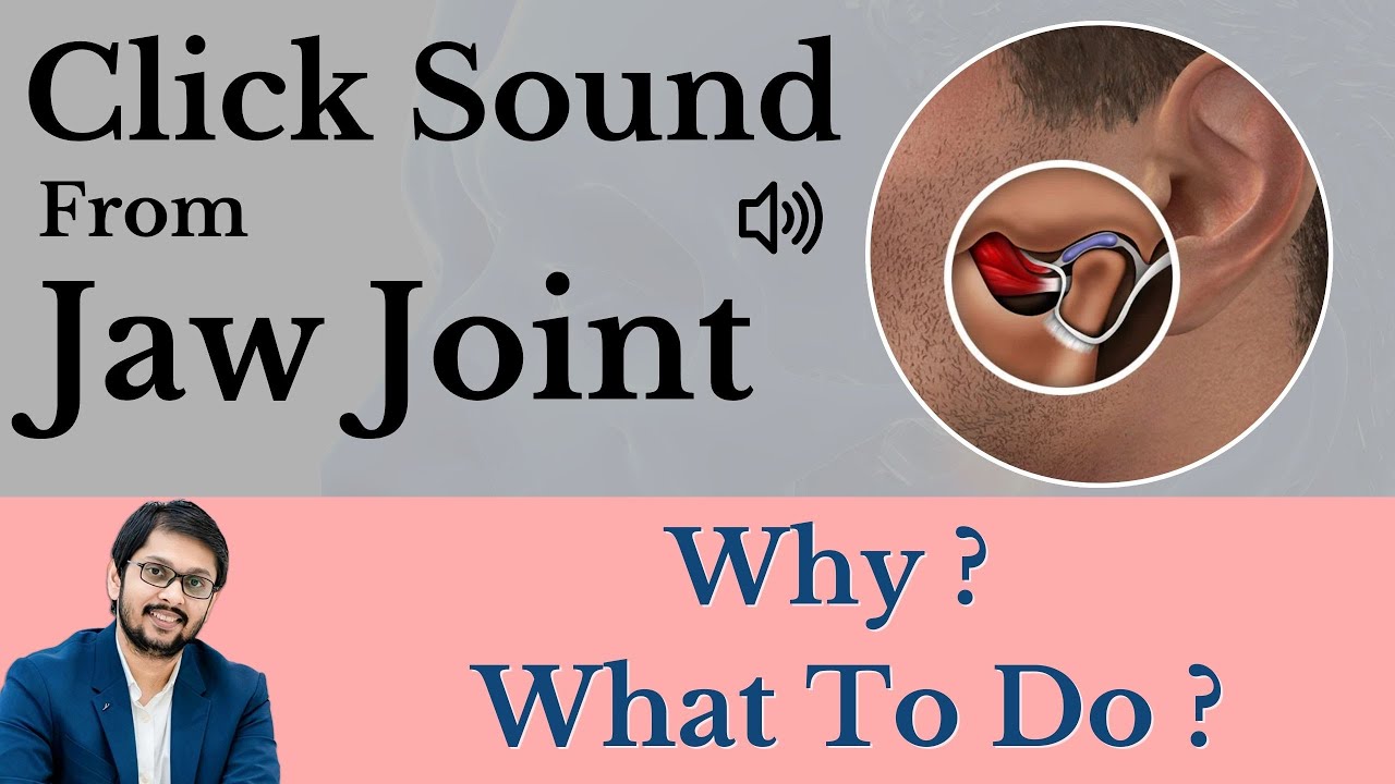 Лечение щелчков в височно-нижнечелюстном суставе в Индоре | Лечение боли в суставах ТМ | Доктор А...