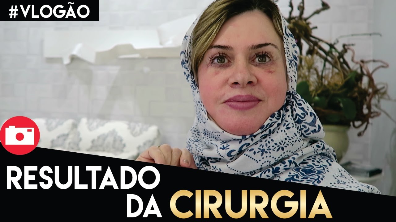 P&Oacute;S CIRURGIA | ALMO&Ccedil;O DE P&Aacute;SCOA EM FAM&Iacute;LIA #VLOG&Atilde;ODASEMANA