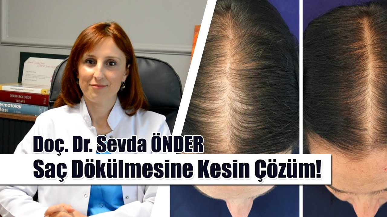 Saç Dökülmesi Sebepleri, Hızlı Tedavi Yöntemleri ve Çözüm Yolları ile Hayatınızı Değiştirin!