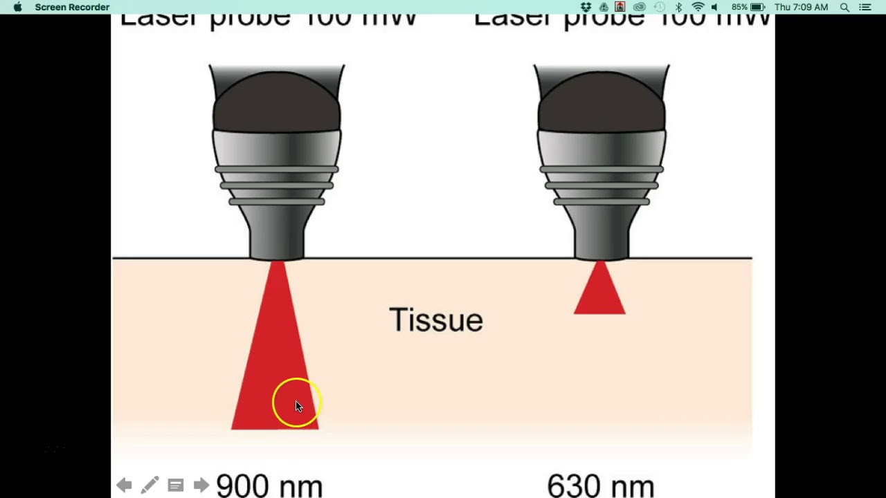Electromagnetic Radiation: Lasers and Low Level Light Therapy