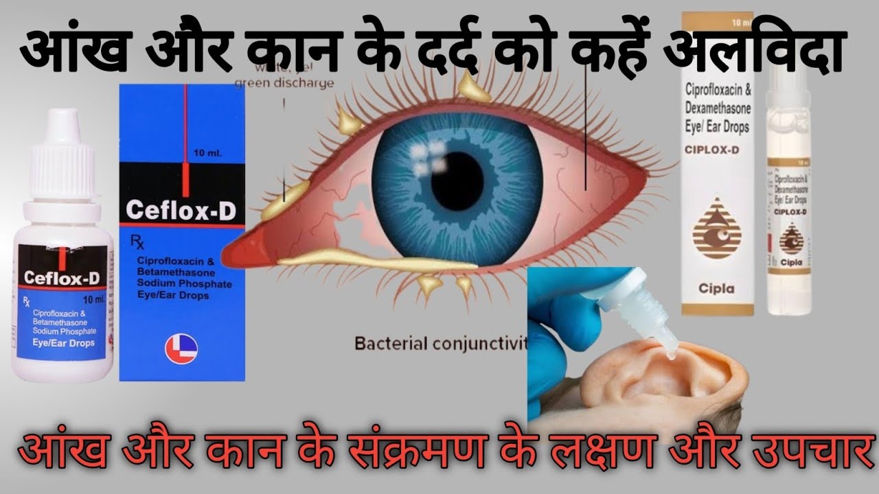 Ciplox-d Eye/Ear drops | eye flu l ear pain drops l conjunctivitis lआंख में एलर्जी की दवा lकान दर्द 