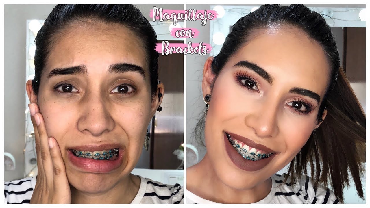 CONSEJOS DE BELLEZA PARA CHICAS CON BRACKETS | Carel Quezada