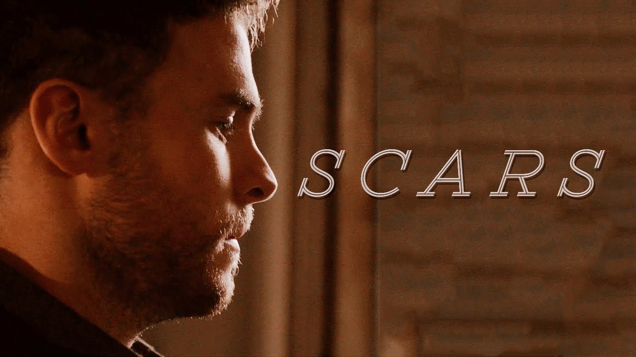 Leo Fitz | Scars