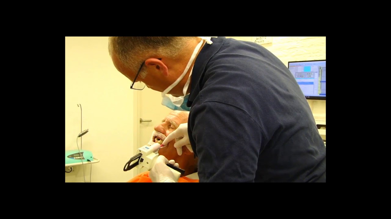 Registro de mordida con Futar D Fast