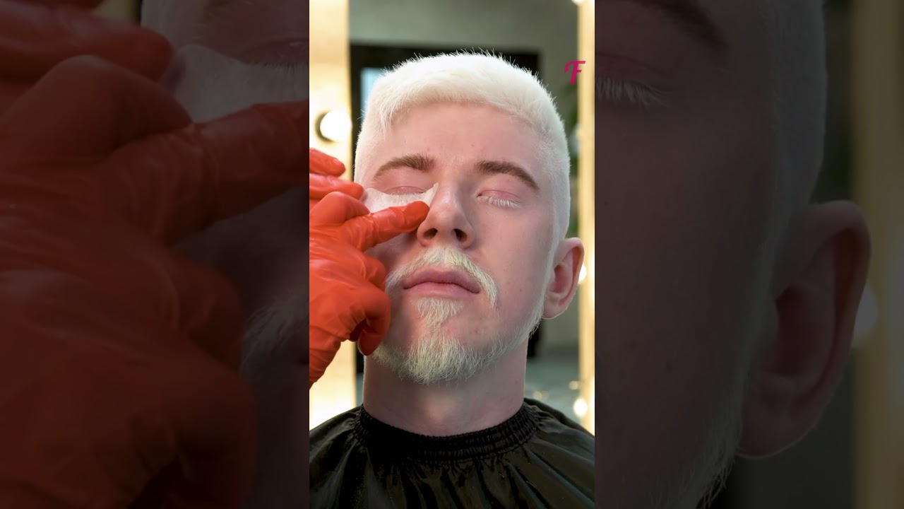 Life-changing makeover for albino man #shorts