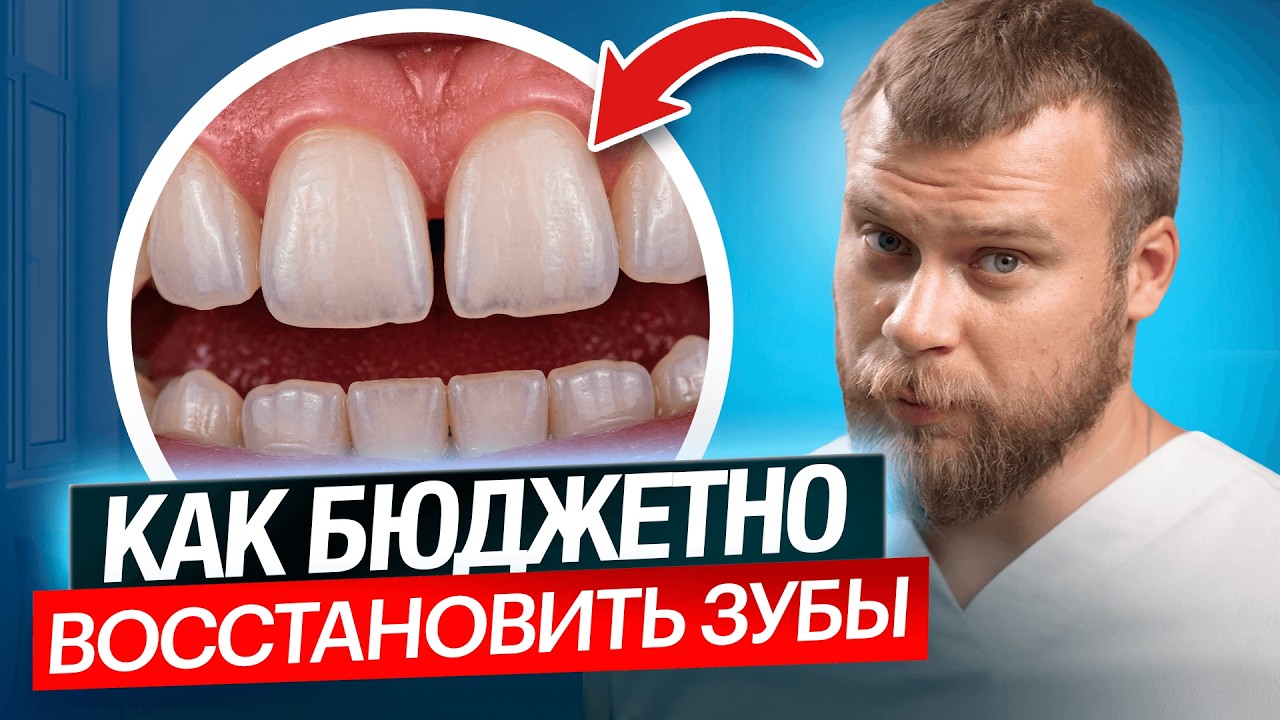 Бюджетно вернуть зубы: почему через 5 лет придётся платить снова и снова