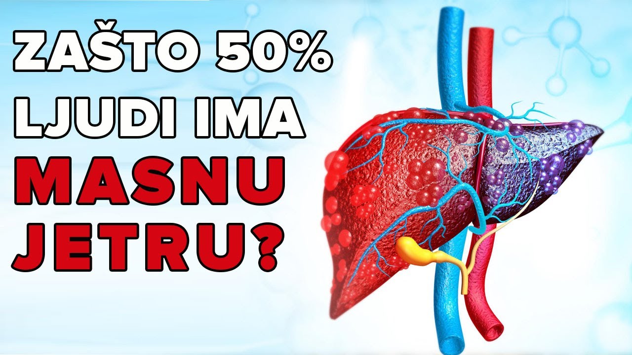 MASNA JETRA SE LIJEČI PRIRODNIM PUTEM! Dr Mihajlović