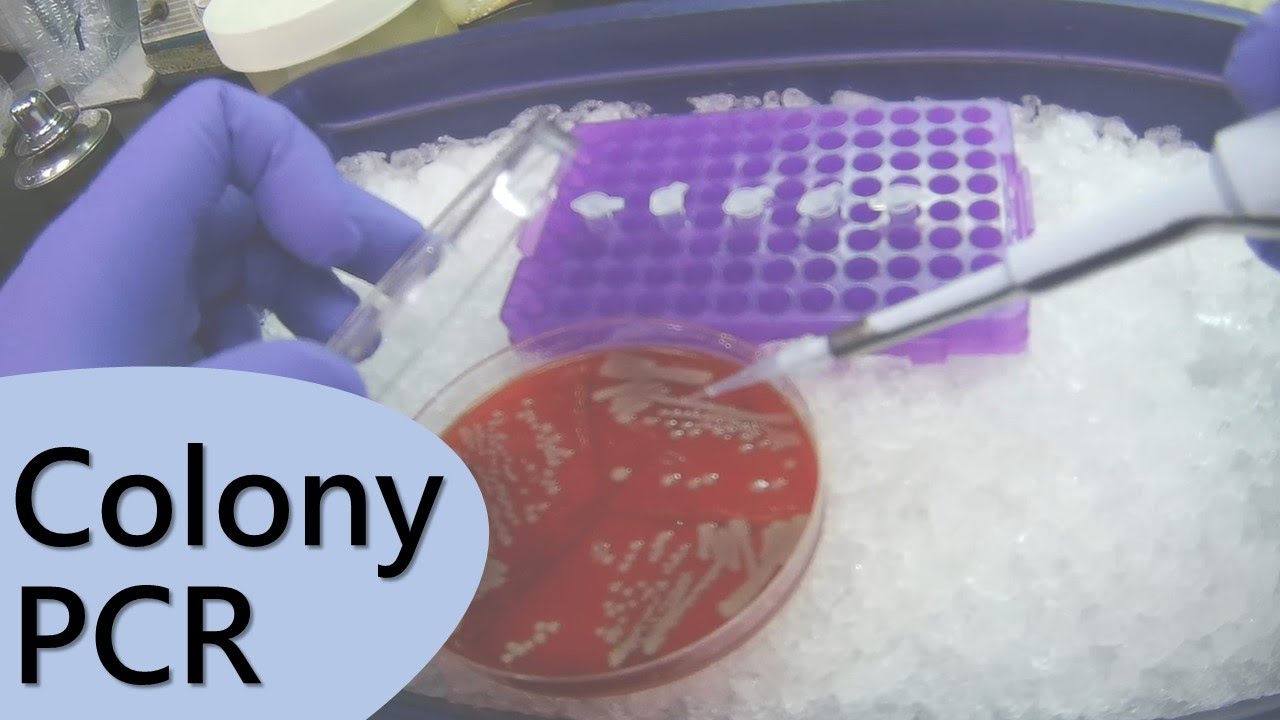 How To Do Colony PCR