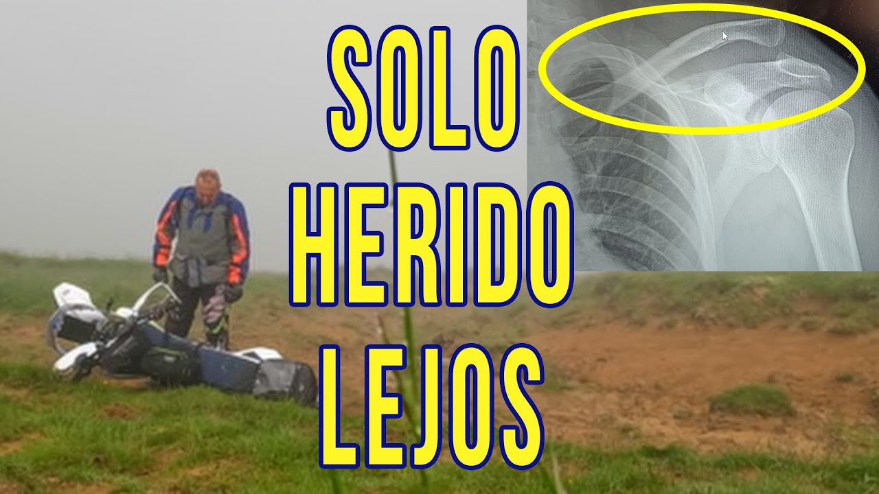 Lesión clavícula en solitario