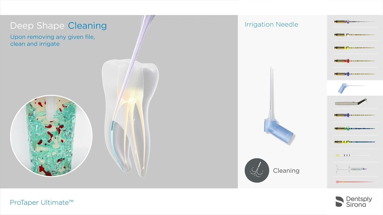 ProTaper Ultimate Endo File System - Full Slider - Shaper - Finisher Sequence