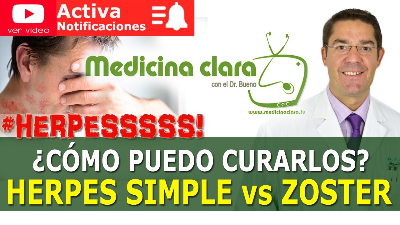 HERPES SIMPLE ⚔️ HERPES ZOSTER. ¿CÓMO SE CURAN? TRATAMIENTO HERPES| Medicina Clara