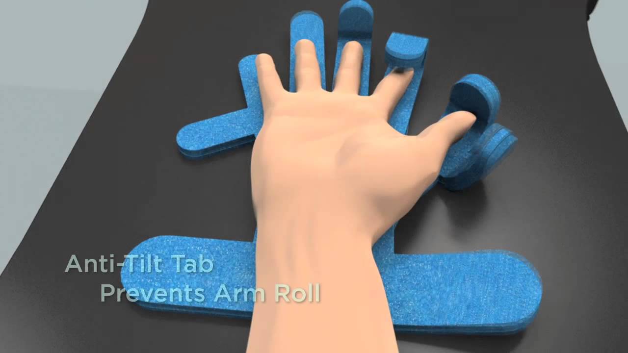 Alumi-Hand & DuraHand replace old lead hands in the OR for safe hand immobilization