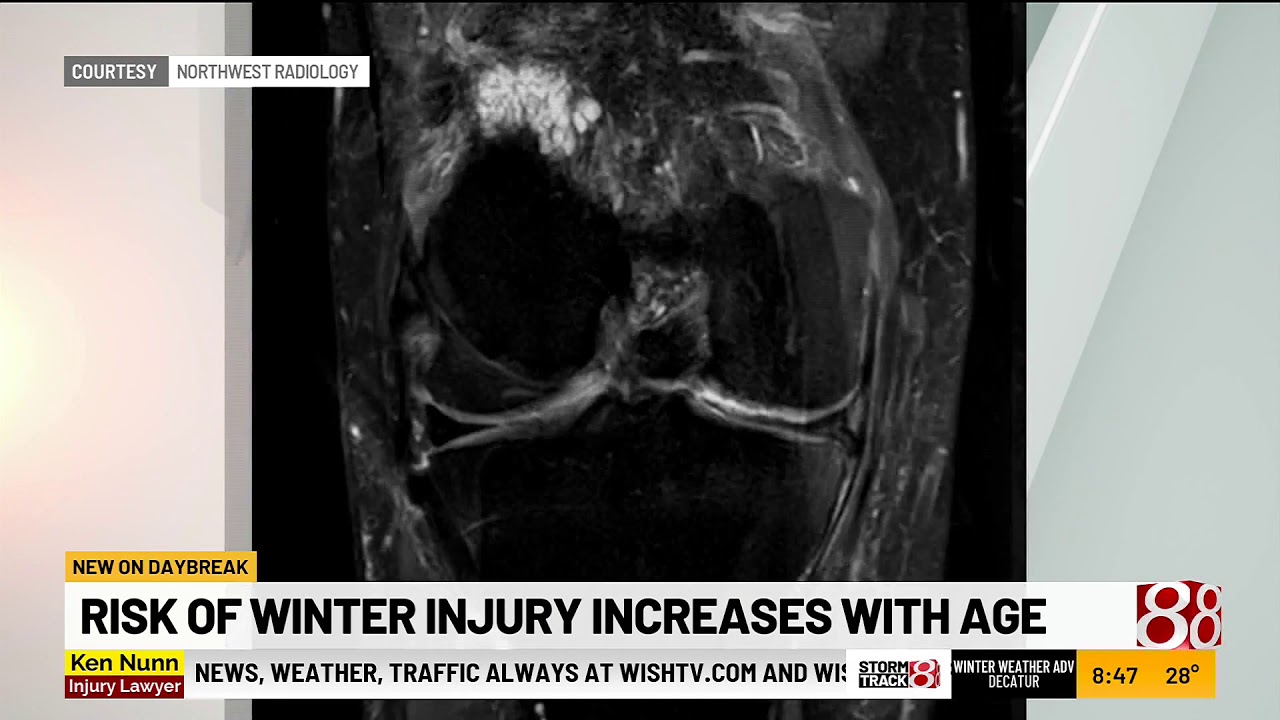 WISH-TV: Senior Injuries with Dr. Catherine King