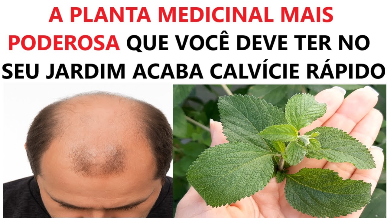 SÓ DUAS FOLHAS! A CALVÍCIE VAI EMBORA e o cabelo cresce em disparada🥰está é a receita mais poderosa!