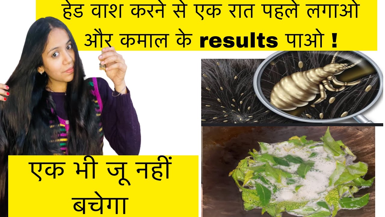 Ek bhi juu, likh , nahi bachegi | diy hair oil |remove head lice permanently | @The beauty vlogs
