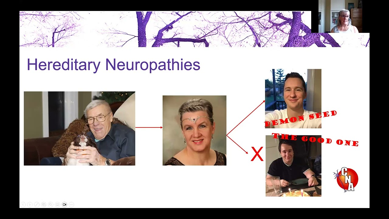 Hereditary Neuropathies