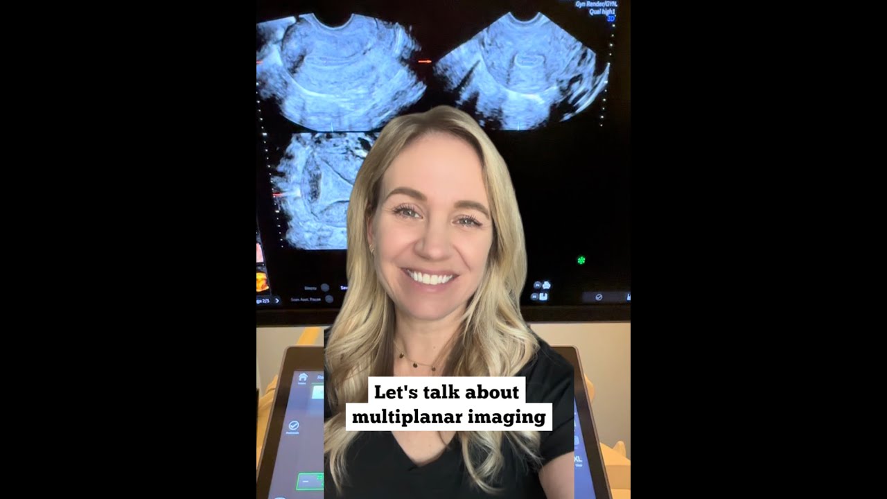 Learn to optimize the coronal plane of the uterus with volume imaging GE HealthCare Voluson Expert22