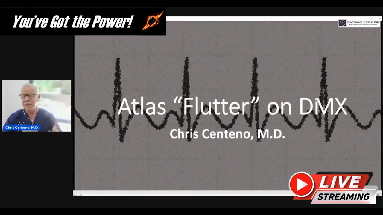 Atlas Flutter on DMX: Why Does C1 Jump in Some CCI Patients?