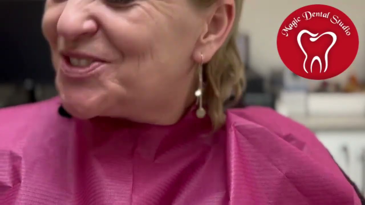 BioFIX kivehető teljes műfogsor