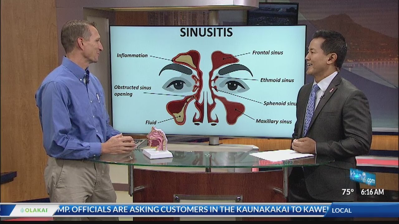Sinusitis vs. The Common Cold - The Queen's Medical Center - Ask a Specialist