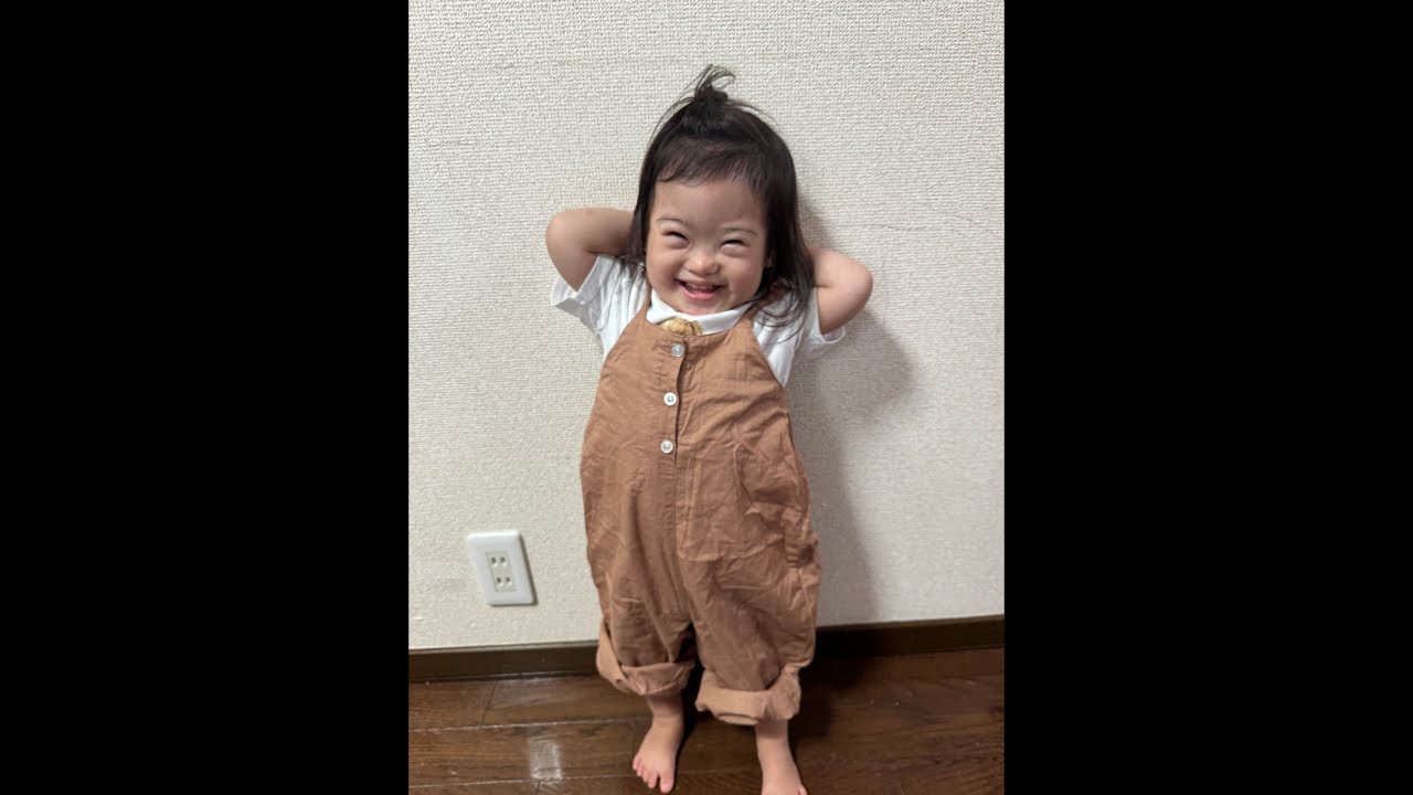 Baby has Down Syndrome 298