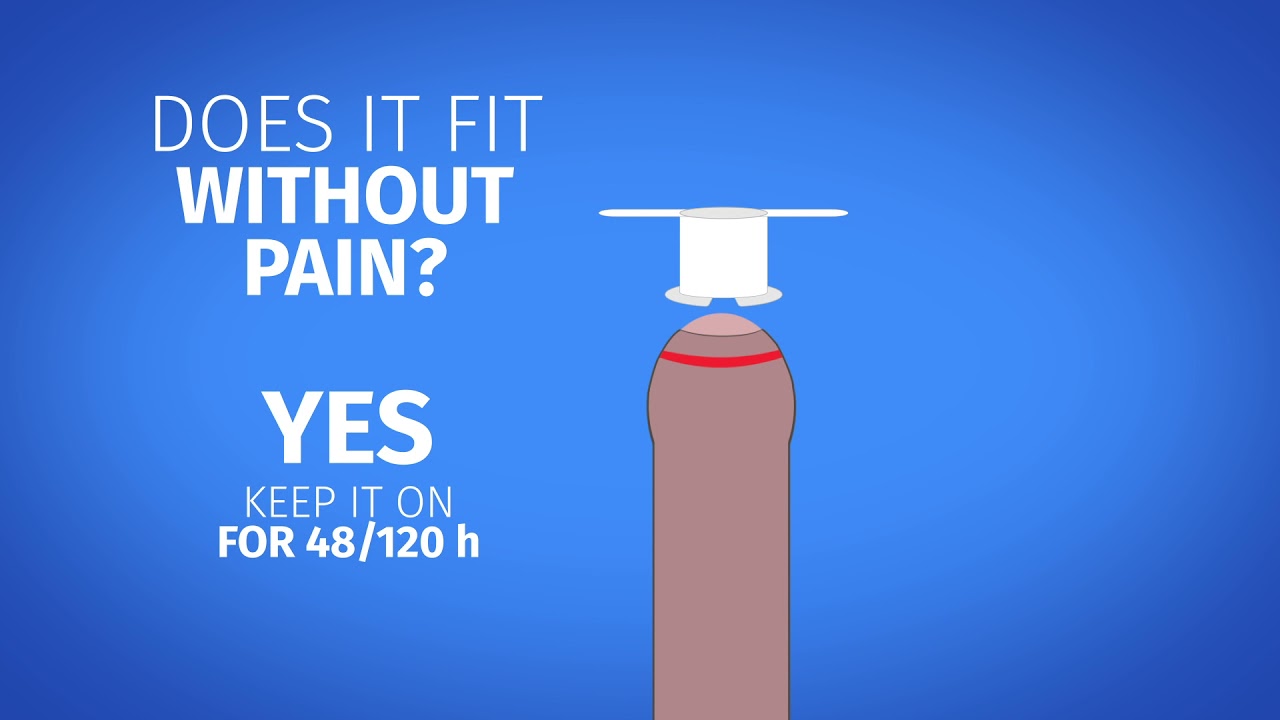 How to treat phimosis with Phimostop: how and when