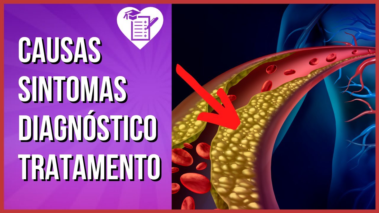 DISLIPIDEMIA: Tipos, Sintomas e Valores de Referência