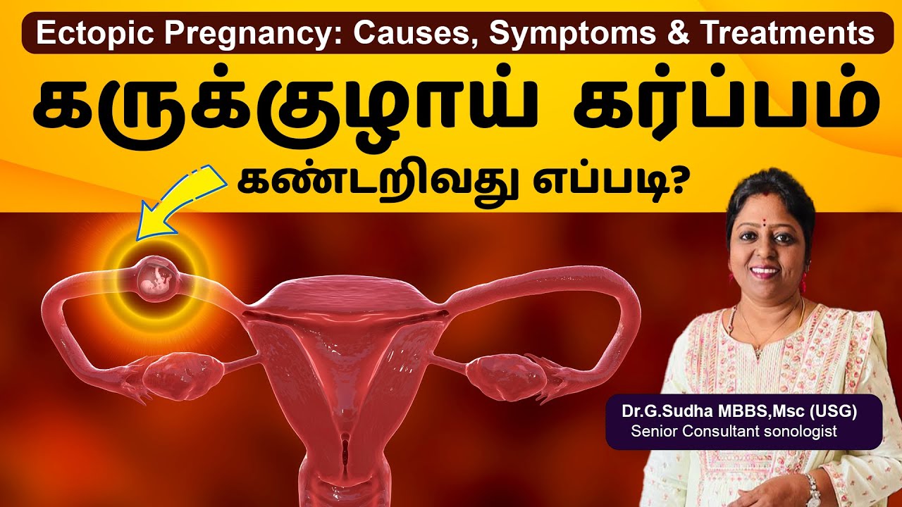 Ectopic Pregnancy Causes | Symptoms | Treatment | கருக்குழாய் கர்ப்பம் கண்டறிவது எப்படி ?