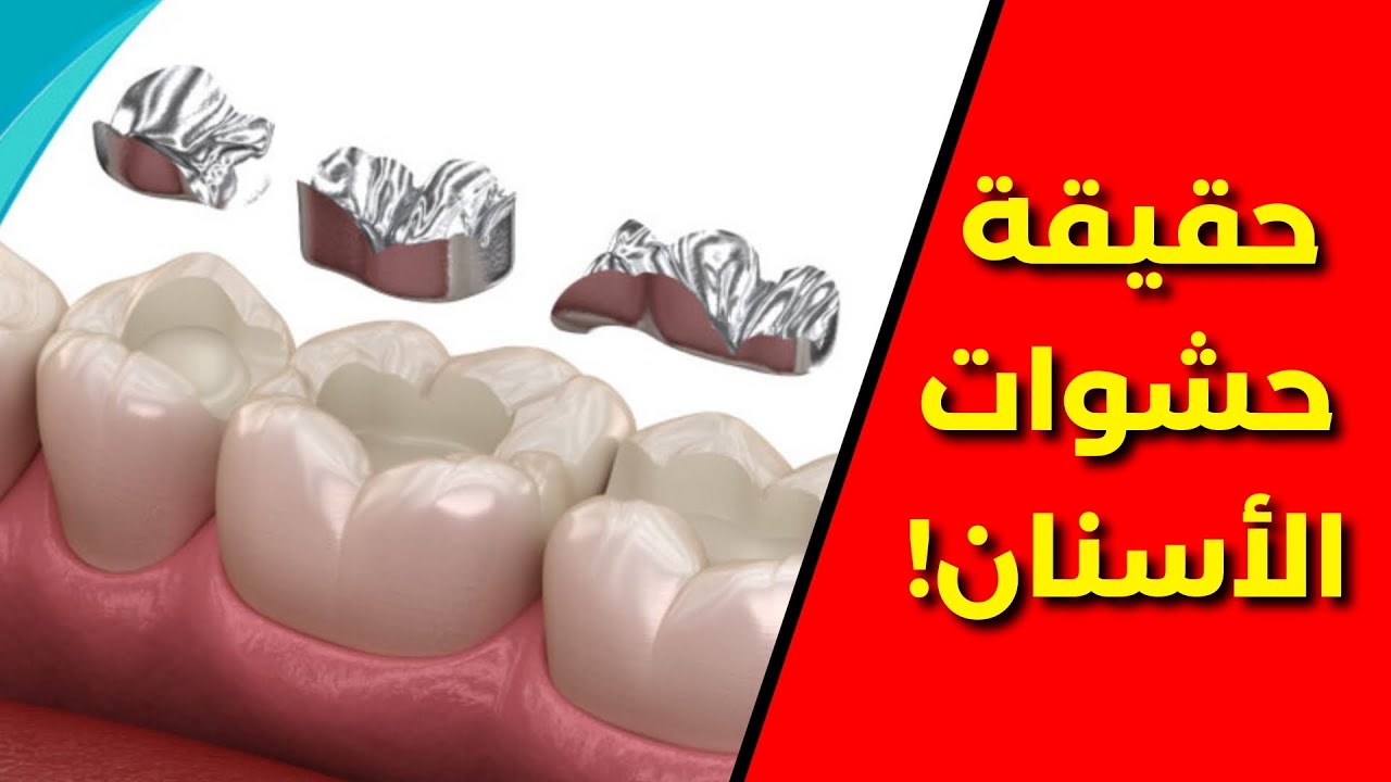 هل حشوات الأسنان تسبب السرطان؟🦷الحقيقة الطبية التي لا يخبرك بها أحد|Do Dental Fillings Cause Cancer?